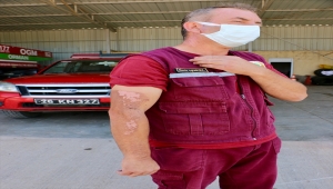 Alevlerden kendini ıslatarak kurtulan ormancı Ümit Işıkel, yaşadıklarını anlattı: