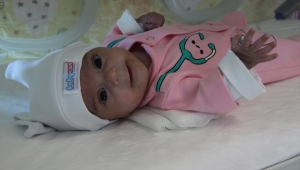 Konya'da 570 gram doğan Ahsen Buğlem bebek hayata tutundu