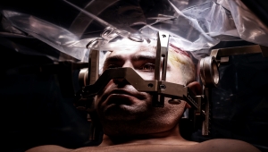 Guinness rekortmeni Doç. Dr. Ali Zırh, 1.000'inci Parkinson ameliyatını yaptı