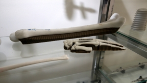 Otomotiv devlerine üretim yapan Sivas'taki fabrika, medikal implant ihracatına da başladı