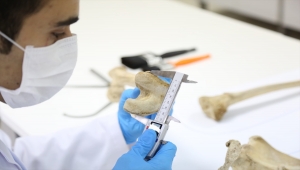 Tanınamaz hale gelen cesetlerin kimlikleri "yeniden yüzlendirme" ile belirleniyor