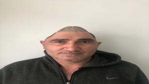 Kafatasının yüzde 83'ü parçalanan hasta, titanyum parçalarıyla eski görüntüsüne kavuştu