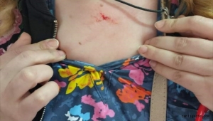 Kayseri'de bir kişi aile sağlık merkezinde ebeyi darbetti