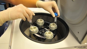 Kayseri'de sahte profesörle 'Tüp Bebek' skandalı Ankara'ya uzandı